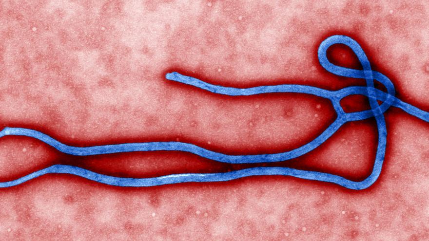 Estructura morfológica del virus ébola