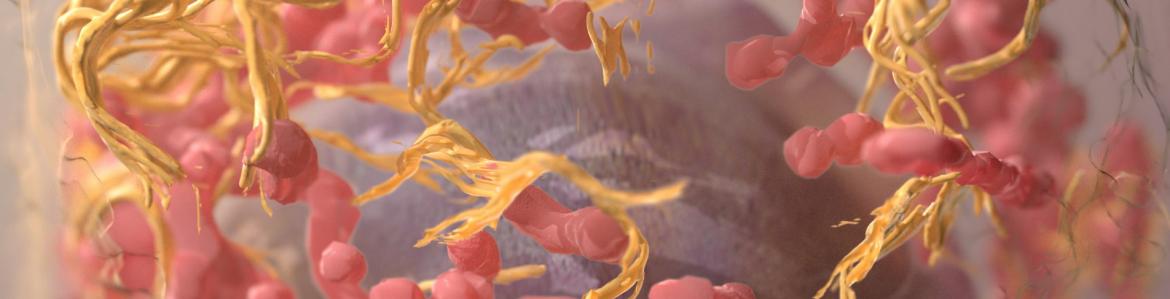 Carcinogenic cells