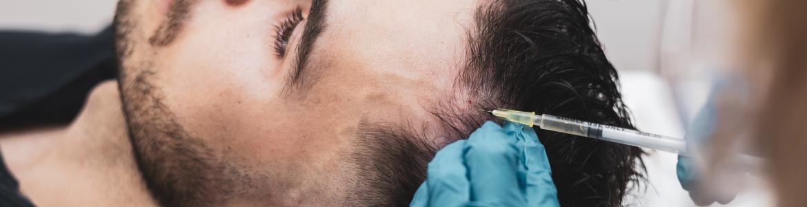 implante clinica capilar