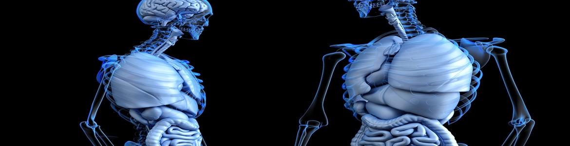 radiografía de dos cuerpos esqueletos con órganos internos