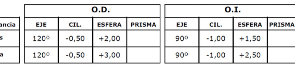 servicio ópticas