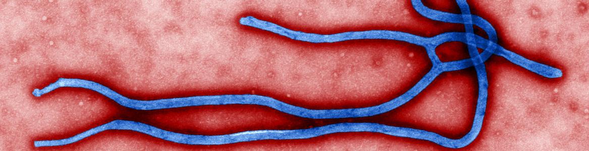 Estructura morfológica del virus ébola