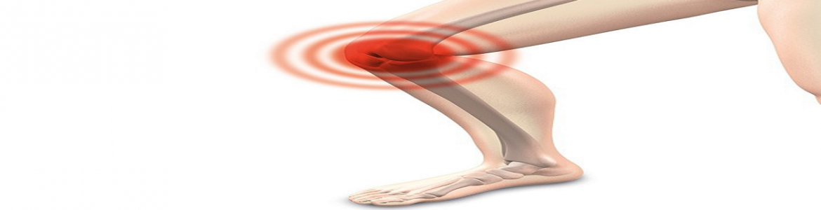 rodilla flexionada con indicadores de dolor