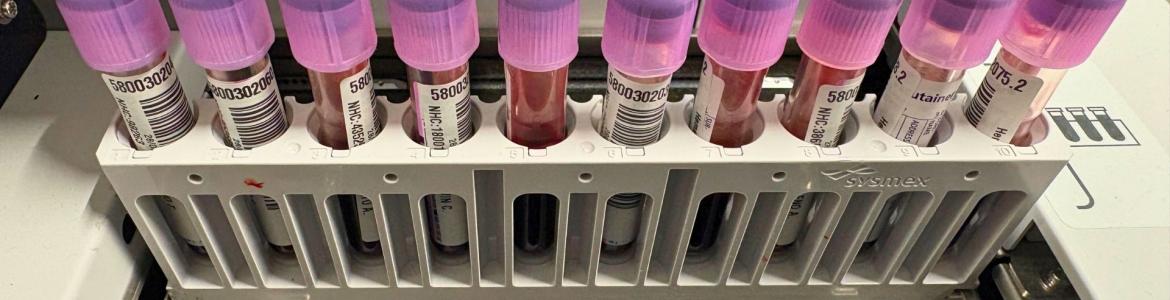 Tubos de laboratorio