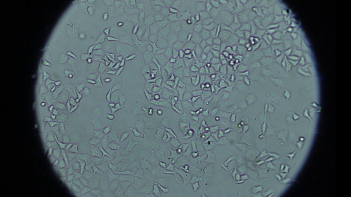 imagen de microscopio de celulitas