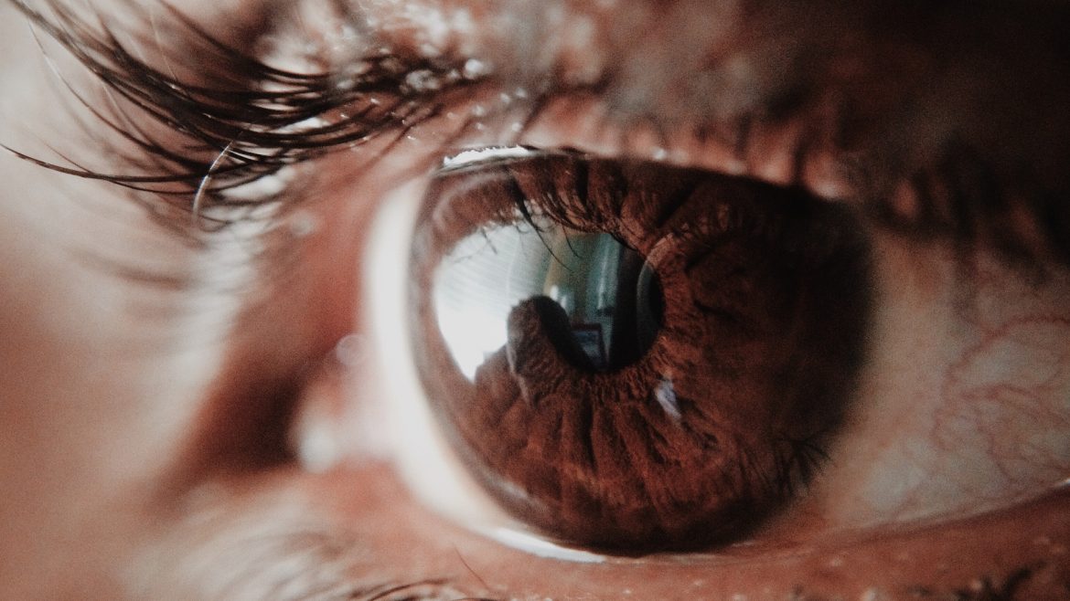 Imagen de un ojo