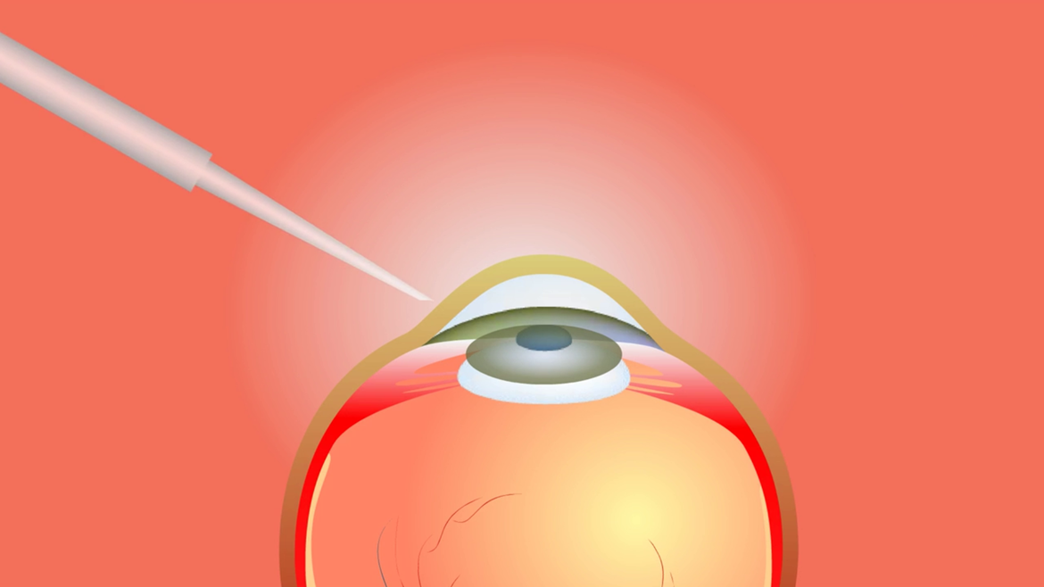 ilustración de un ojo