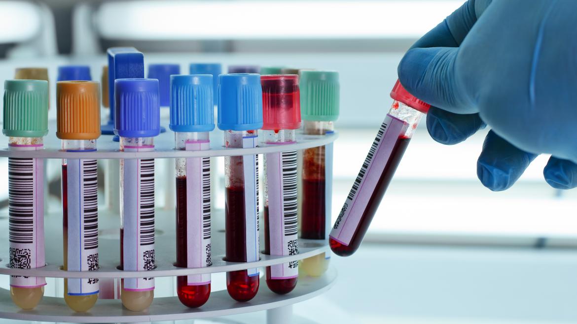 Tubos de muestras analíticas de sangre