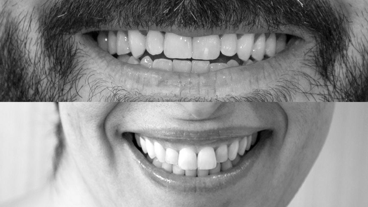 Sonrisas de pacientes de salud mental