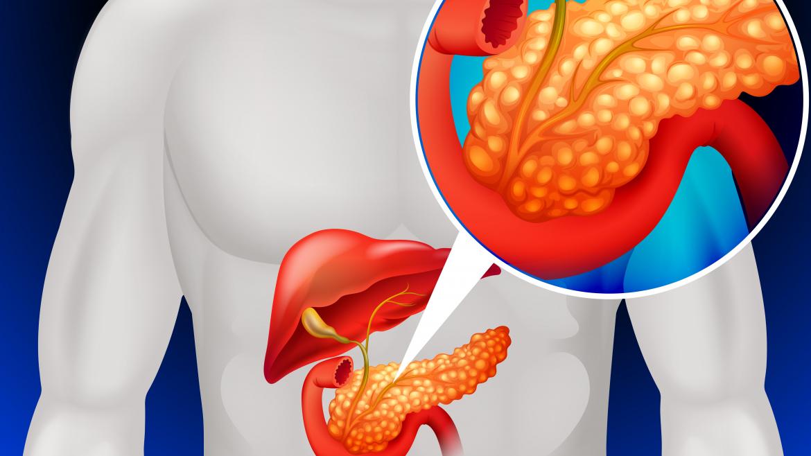 estudio cáncer de pancreas