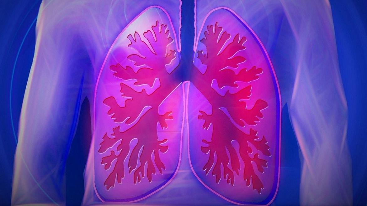 IMAGEN PULMONES.