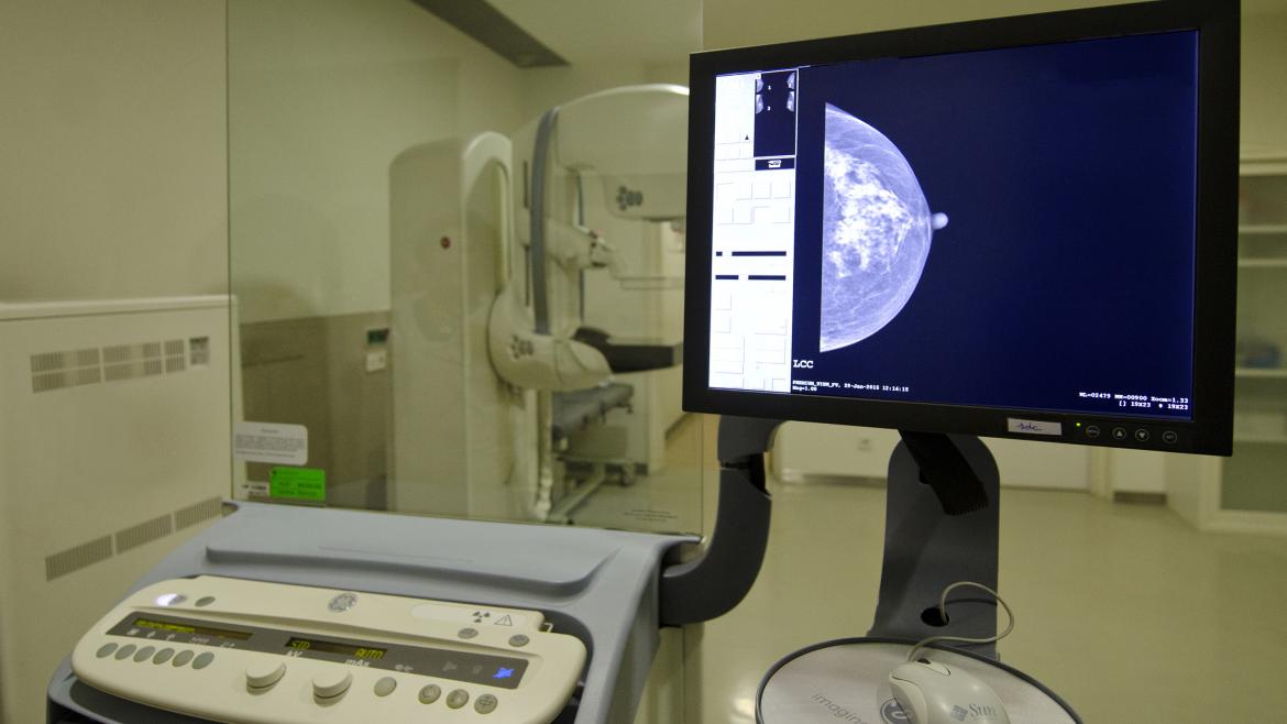 Mamógrafo del Hospital Gregorio Marañón Imagen de un mamógrafo