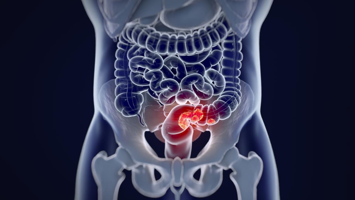 Ilustración cuerpo humano intestinos
