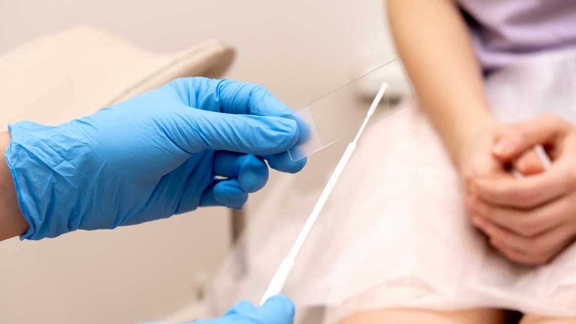 manos profesional sanitario citología mujer