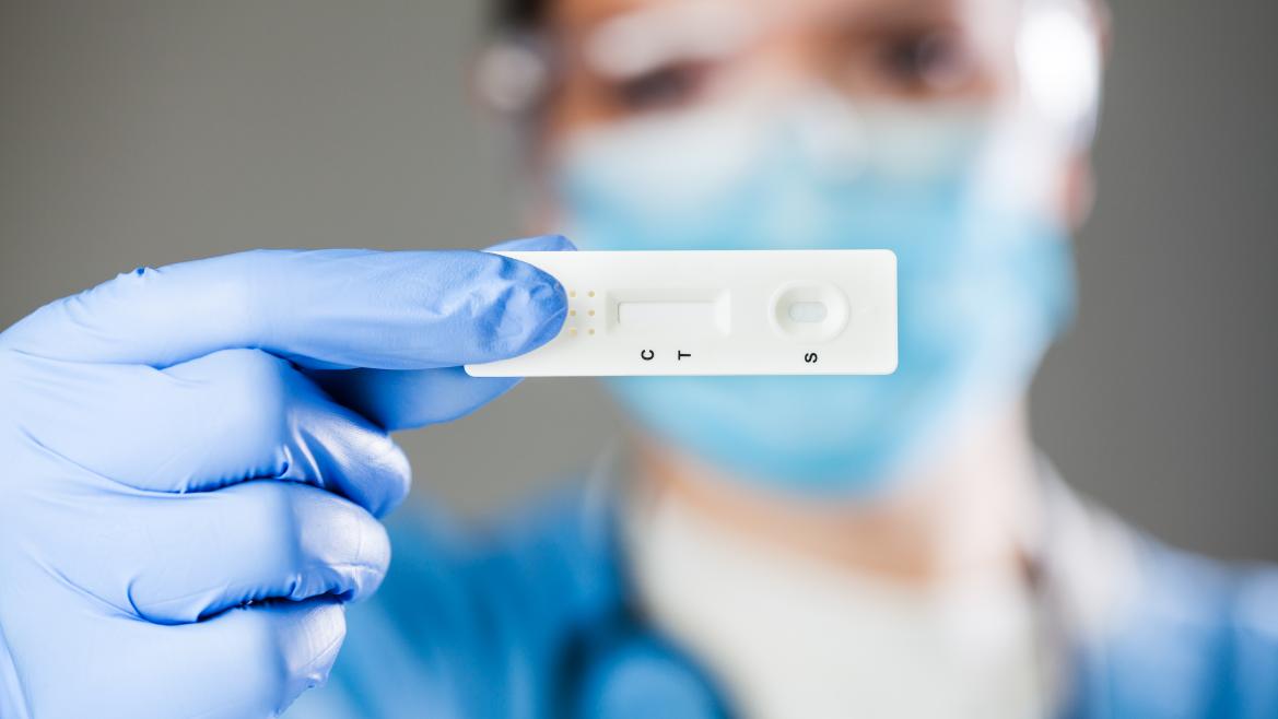 Una muestra de un test de antígenos 