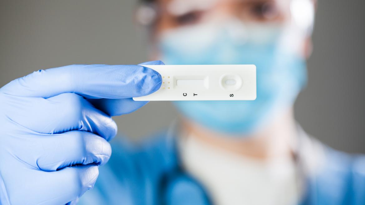 Una muestra de un test de antígenos 