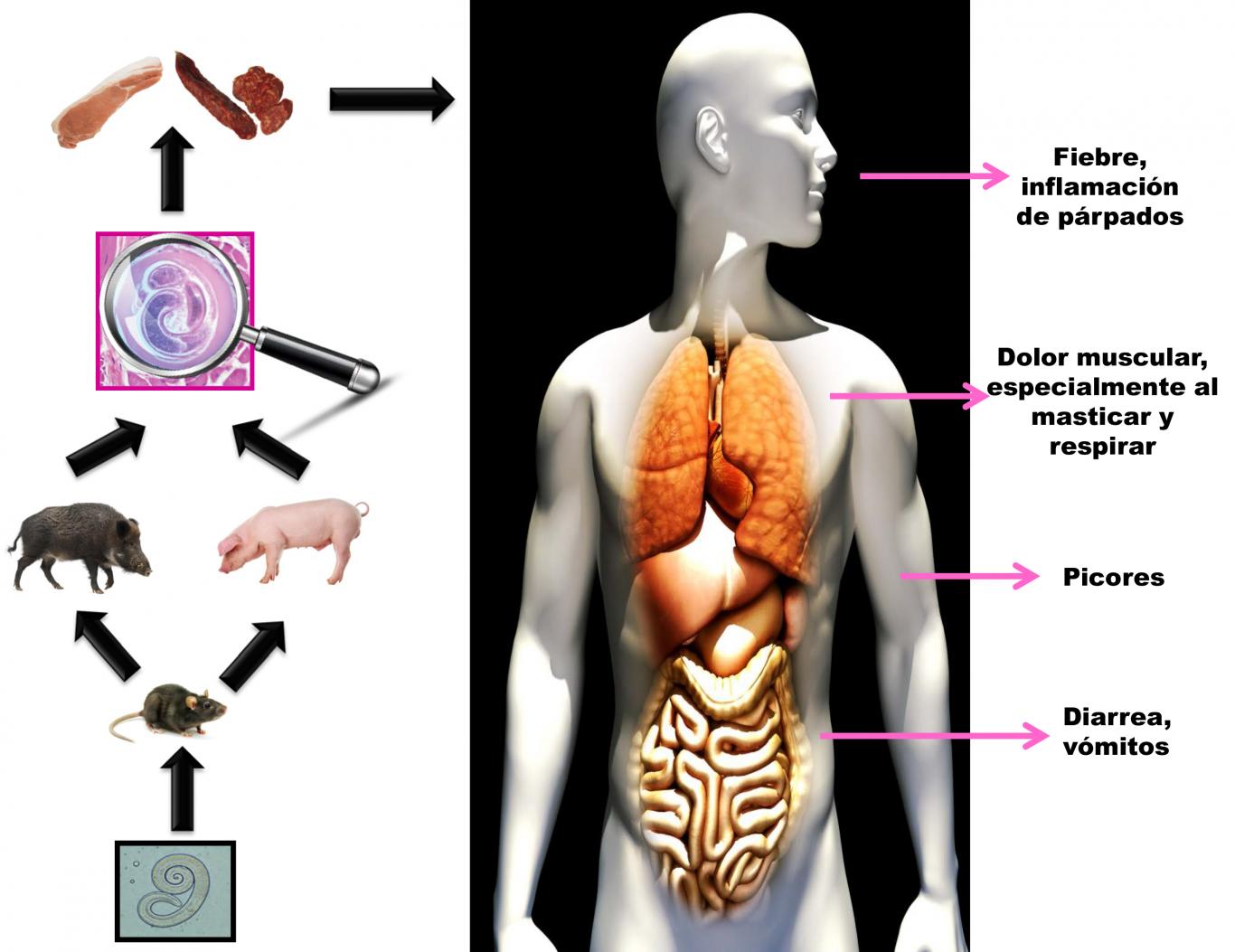 Ciclo de la triquinosis al consumir alimentos contaminados