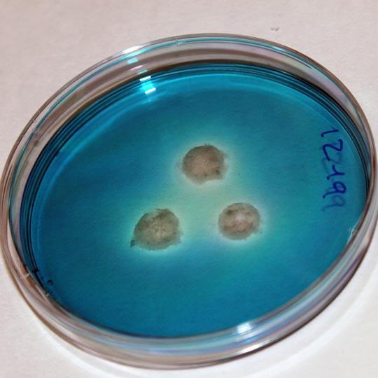 Unidad de Bacteriología