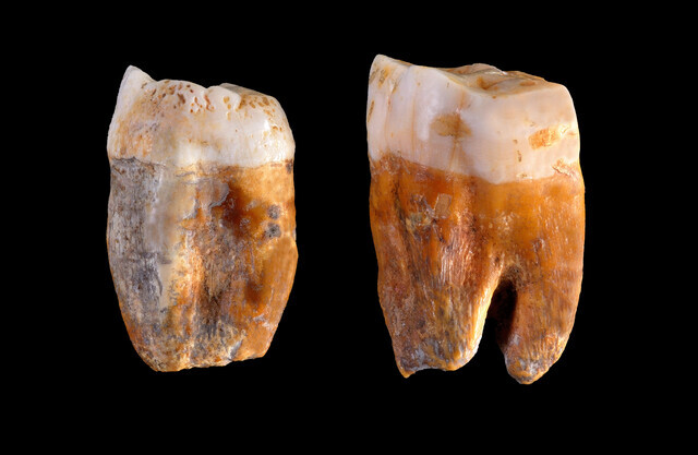 Molars of Homo neanderthalensis