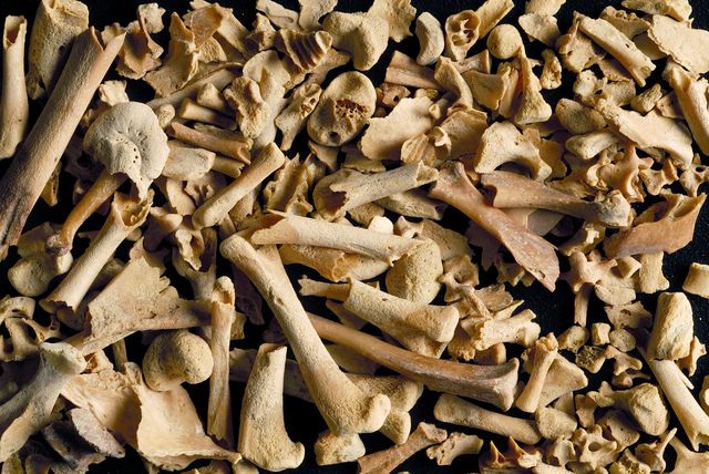 Skeletal bones
